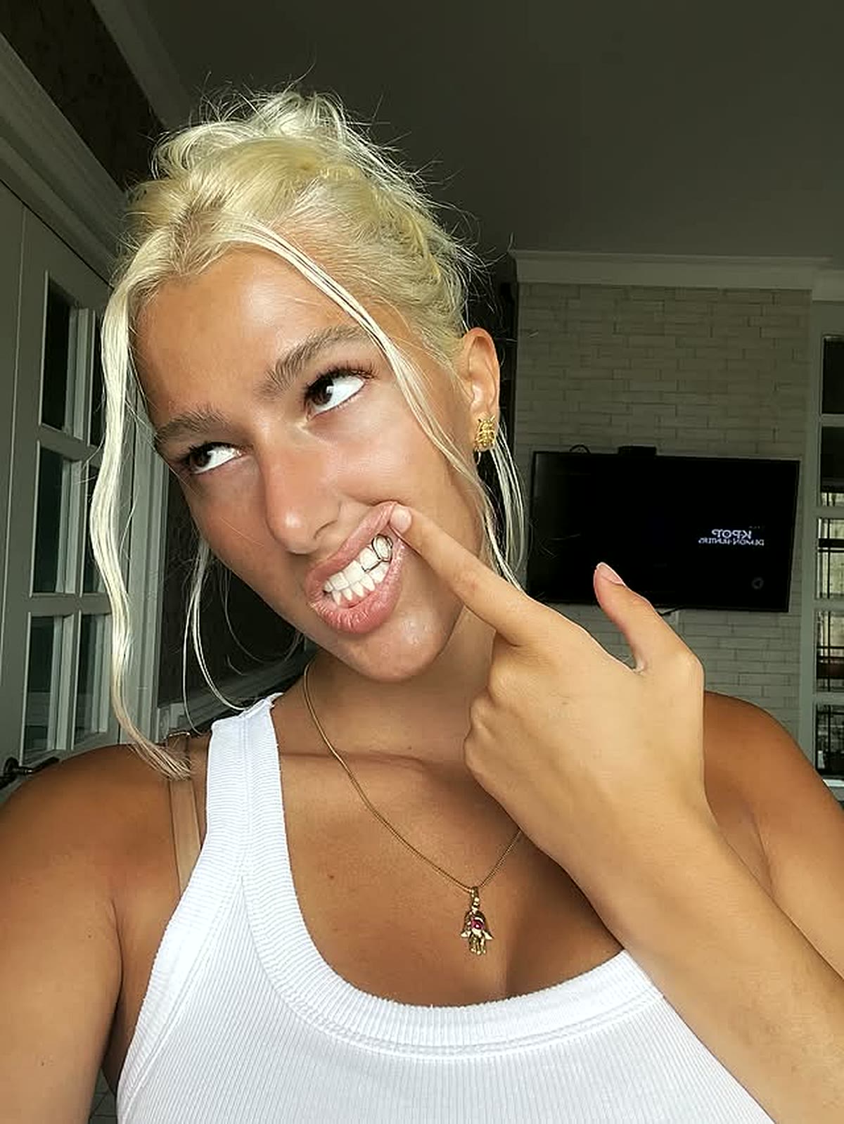 Custom gold grillz cap
