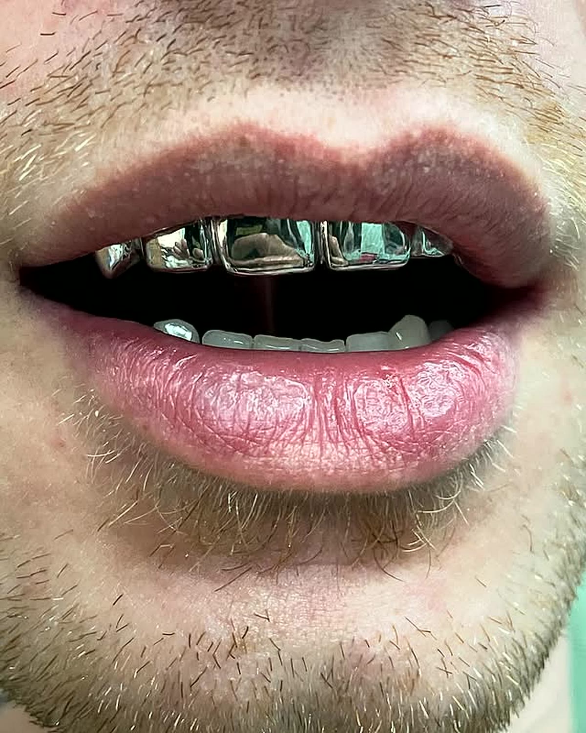 Enger Ausschnitt: Lippen rahmen eine Reihe Silber-Grillz